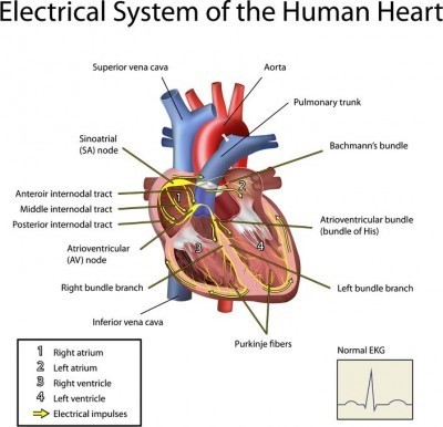 normal heart rhythm originating from the sinus node is termed