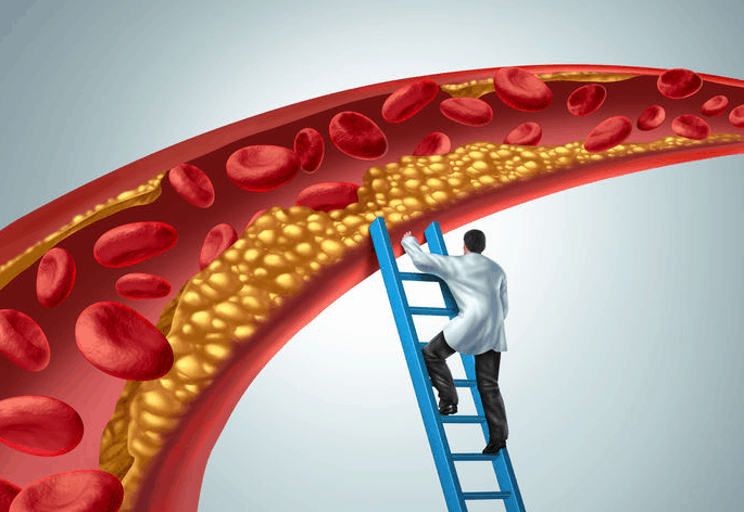 Low-Density Lipoprotein (LDL) in Atherosclerosis and Heart Disease