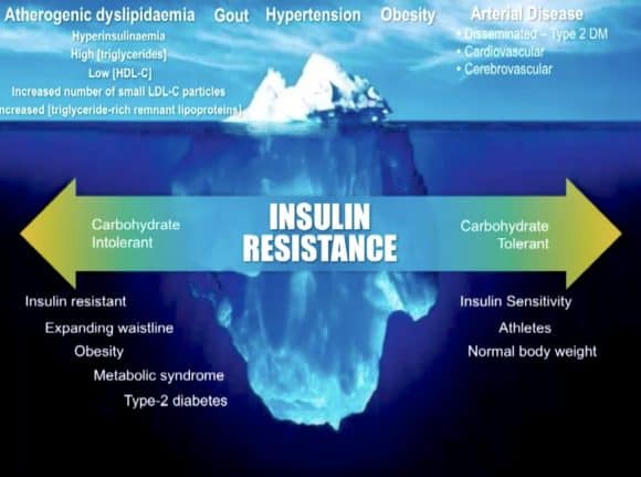 From Low-Fat, High-Carb to Insulin Resistance, Fatty Liver, and Heart Disease