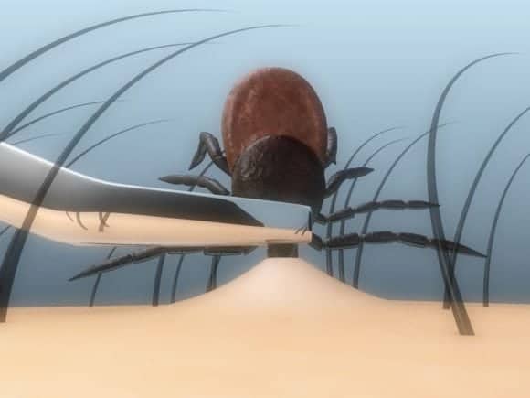 Lyme Disease – 15 Questions and Answers About Causes, Symptoms, Prevention, and Treatment