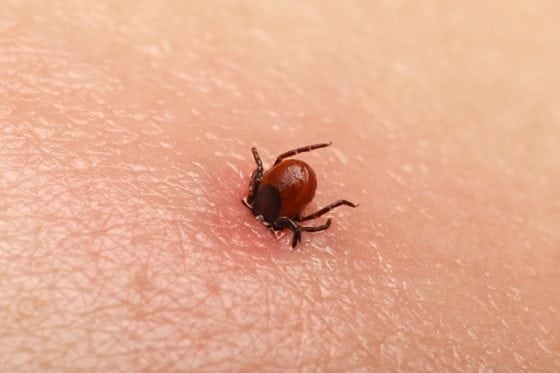 Lyme Disease – 15 Questions and Answers About Causes, Symptoms, Prevention, and Treatment