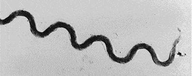 Lyme Disease – 15 Questions and Answers About Causes, Symptoms, Prevention, and Treatment