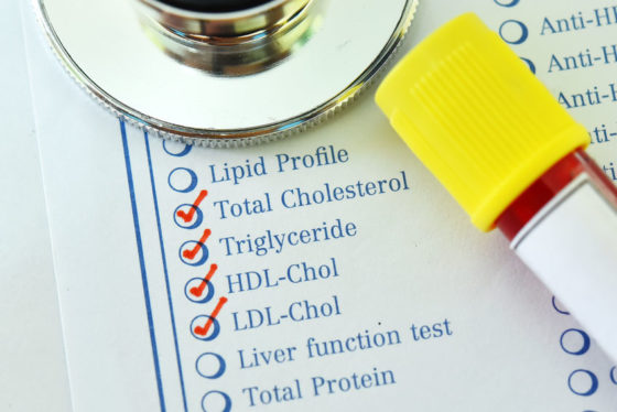 Non HDL cholesterol