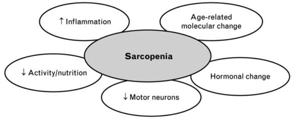 Sarcopenia