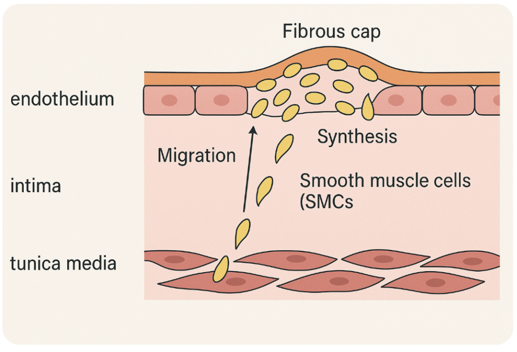 The Making of a Heart Attack: The 12-Step Biology of Atherosclerosis